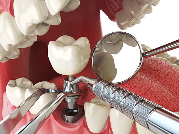 Best Emergency Denture Repair in La Verkin, UT
